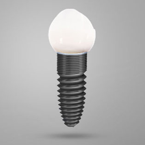 4 Myths Surrounding Dental Implants | El Paso, TX