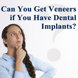 Can You Get Veneers if You Have Dental Implants?