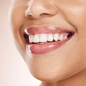 Common Myths About Teeth Whitening in El Paso Debunked