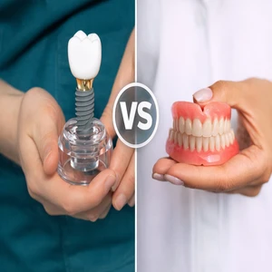 Dental implants in El Paso compared with traditional dentures in a side-by-side visual