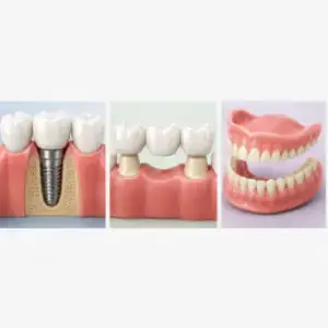 Helpful dental information about dental implants El Paso