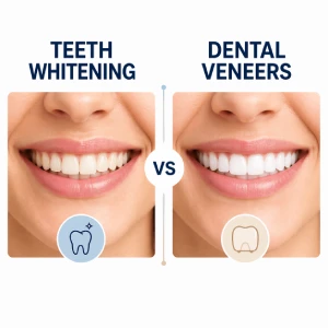 Visual comparison of Teeth Whitening in El Paso vs Veneers for improving smile appearance