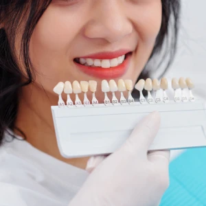 Patient comparing tooth shades with a dentist, illustrating dental veneers in El Paso for a brighter, more even smile.